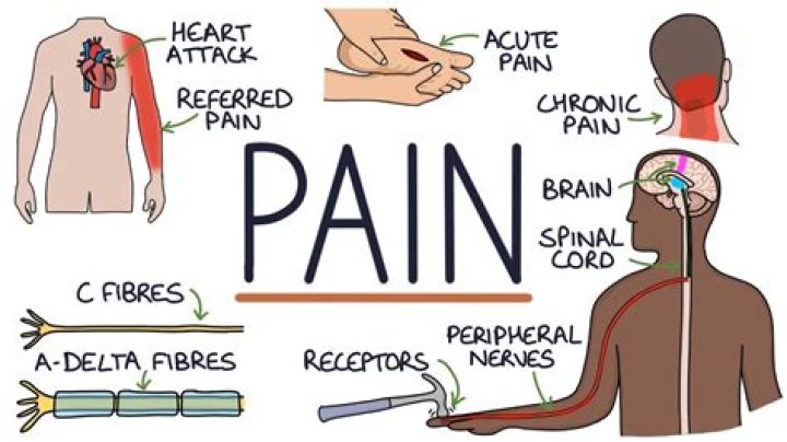 Understanding BEM Pain: Causes and Relief Strategies